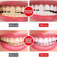 Yayashi SP-4 Ultra Whitening Toothpaste | Stain Remover & Fresh Breath Formula